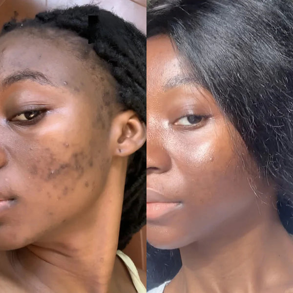 Avant/Après Fatoumata G.