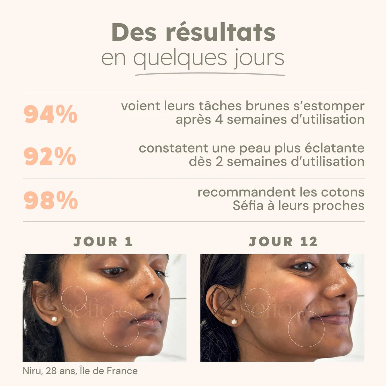 Cotons à l’acide kojique & curcuma – anti-imperfections