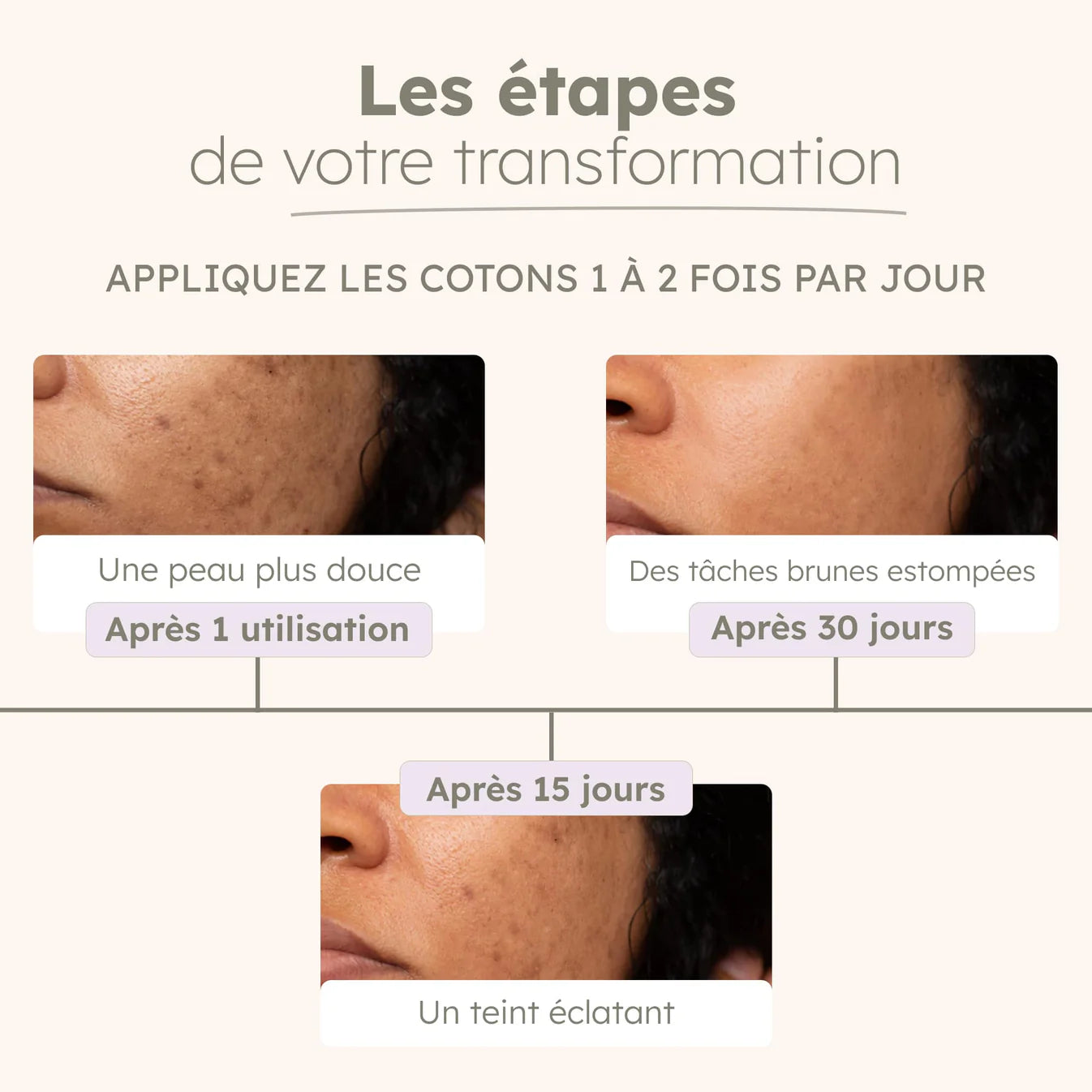 Cotons à l’acide kojique & curcuma – anti-imperfections