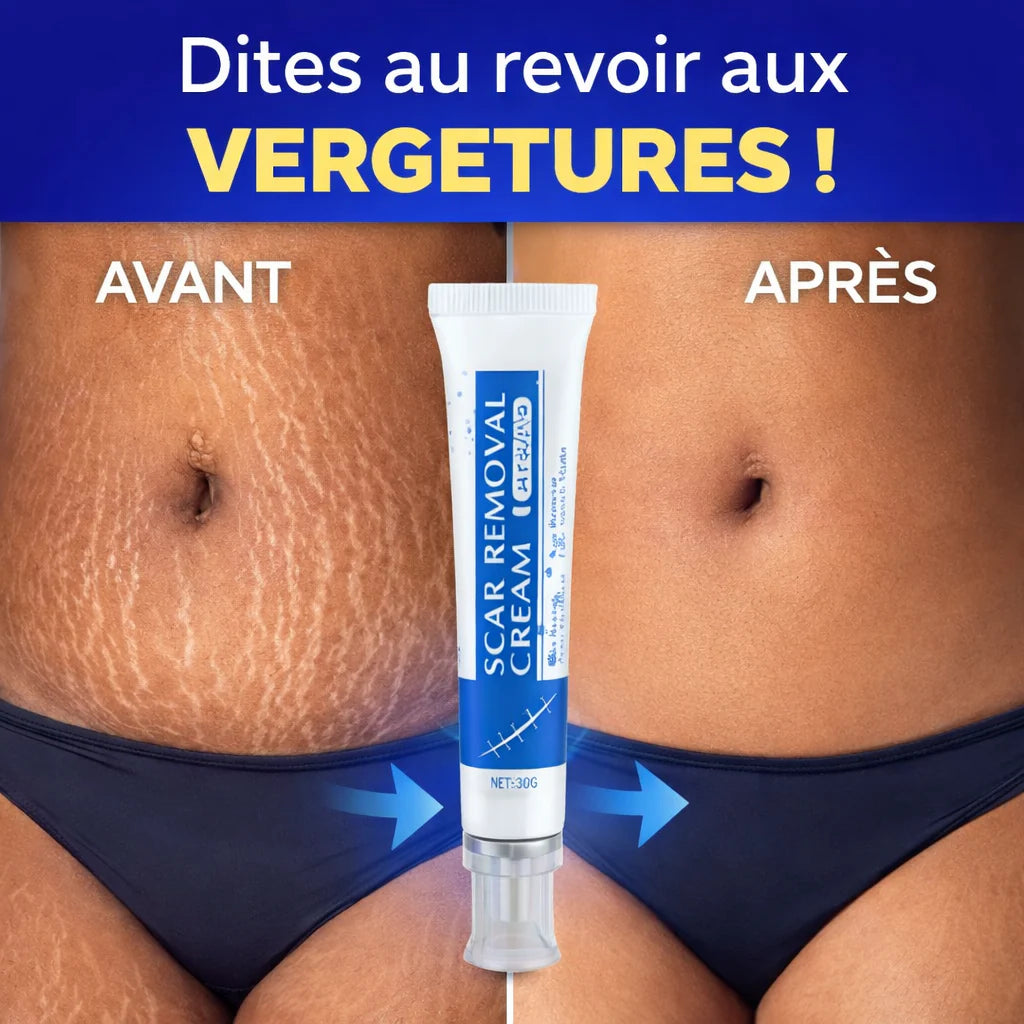 NOVIRACI™ Crème Réparatrice Anti-Cicatrices et Vergeture