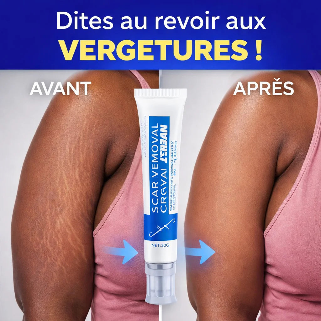 NOVIRACI™ Crème Réparatrice Anti-Cicatrices et Vergeture