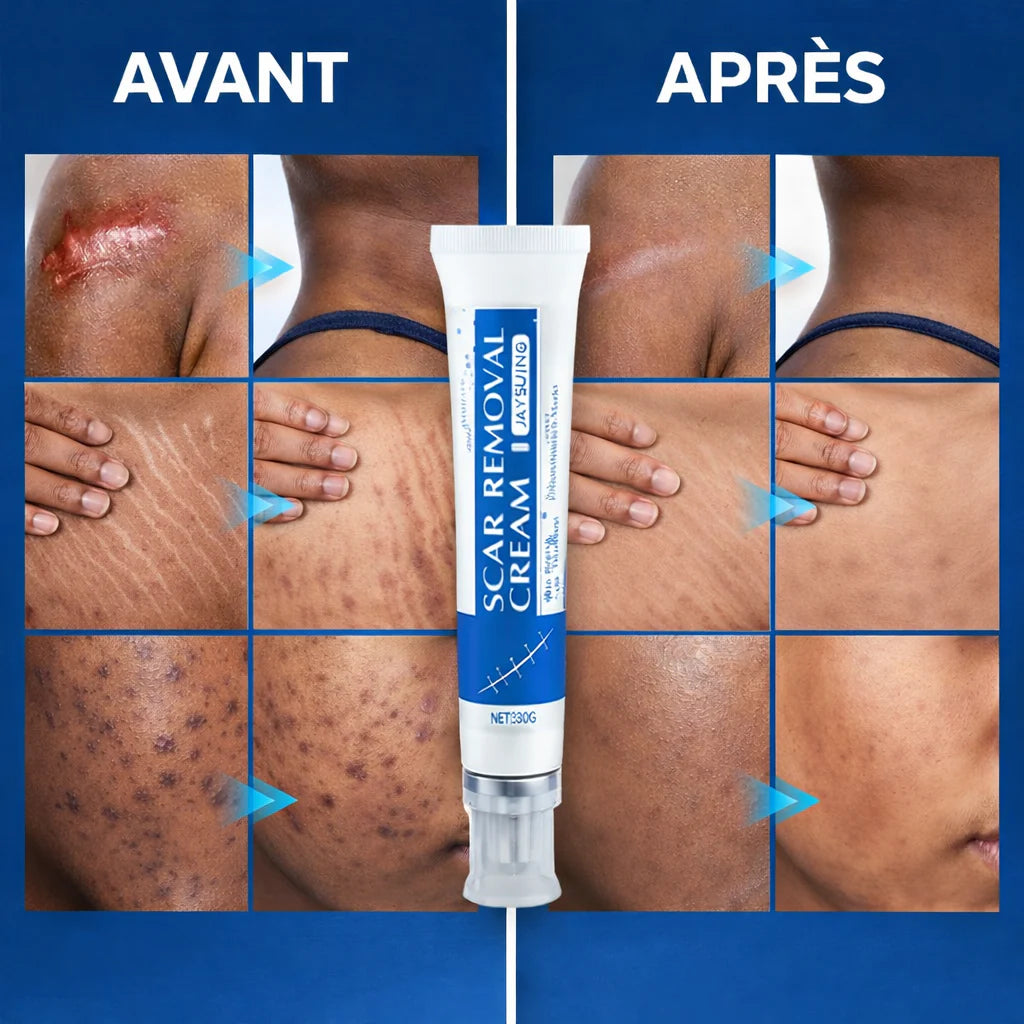 NOVIRACI™ Crème Réparatrice Anti-Cicatrices et Vergeture
