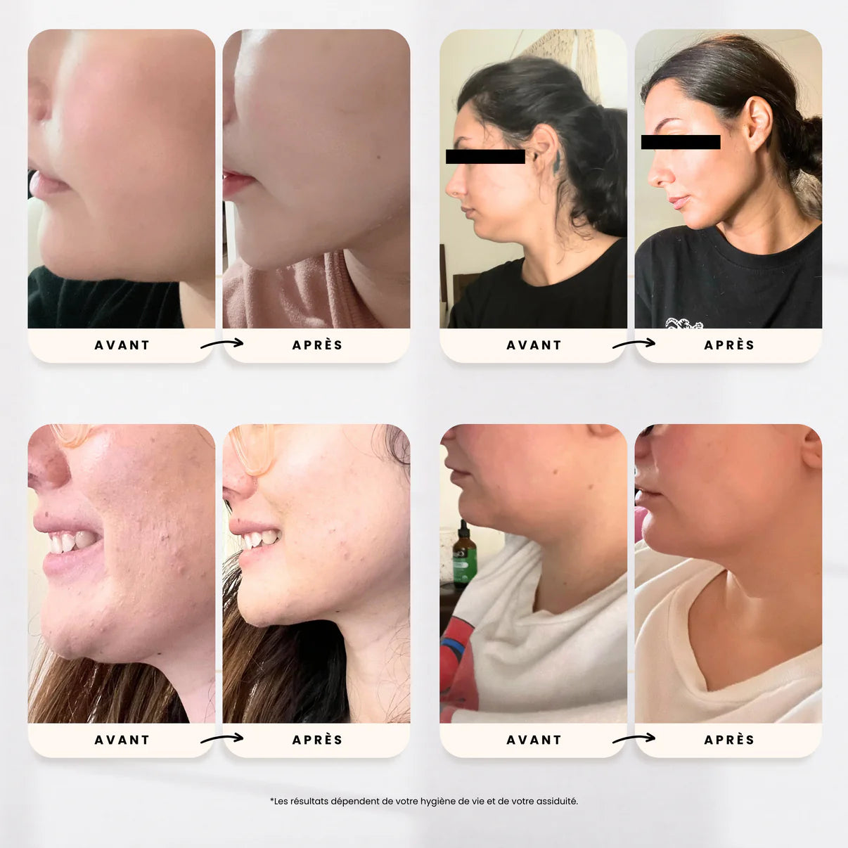 Gaine de visage minceur anti-double menton
