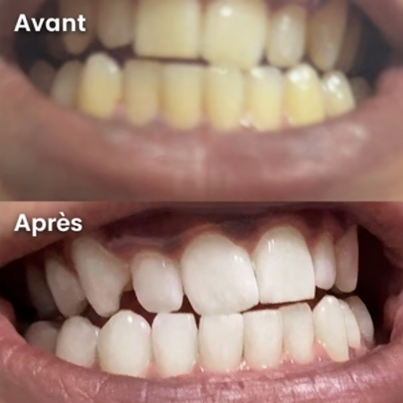 Je souris enfin sur les photos !
