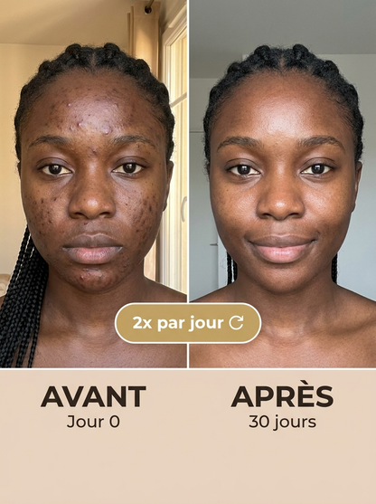 NOVIRACI® Crème Coréenne 345 Anti-Imperfections — Soin Réparateur Dr. Althea