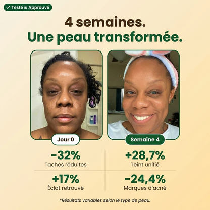 NOVIRACI® Savon Anti-Taches & Hyperpigmentation au Curcuma & Kojique