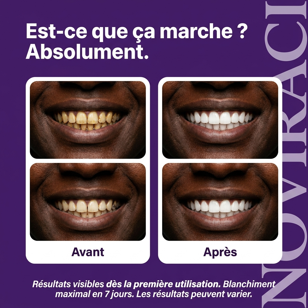 NOVIRACI® Bandes de Blanchiment Dentaire Instantané Dr.Dent