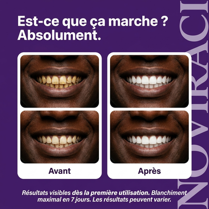 NOVIRACI® Bandes de Blanchiment Dentaire Instantané Dr.Dent