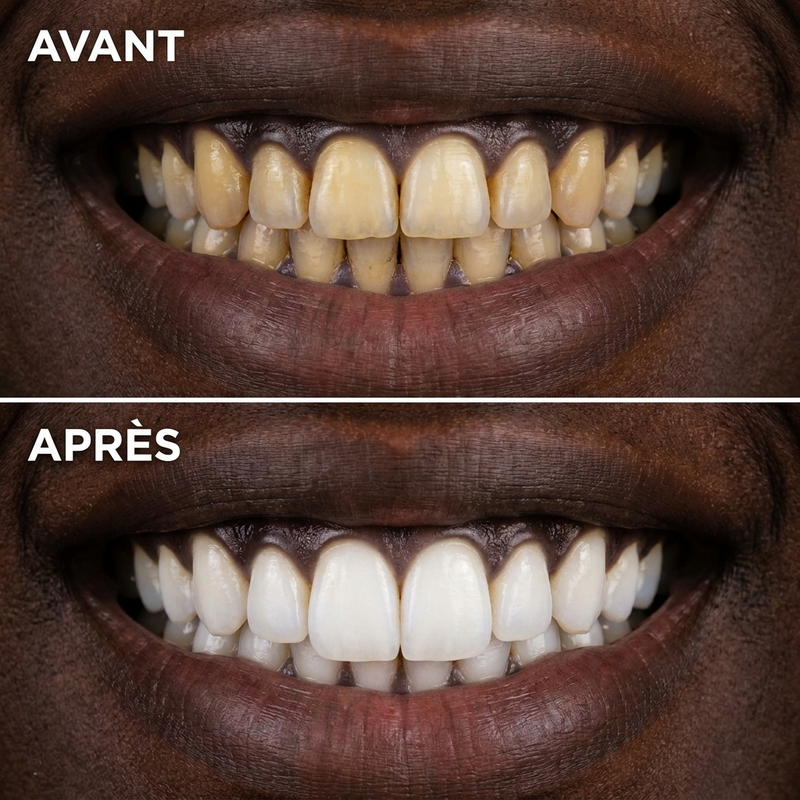 Les résultats instantanés sont bien réels