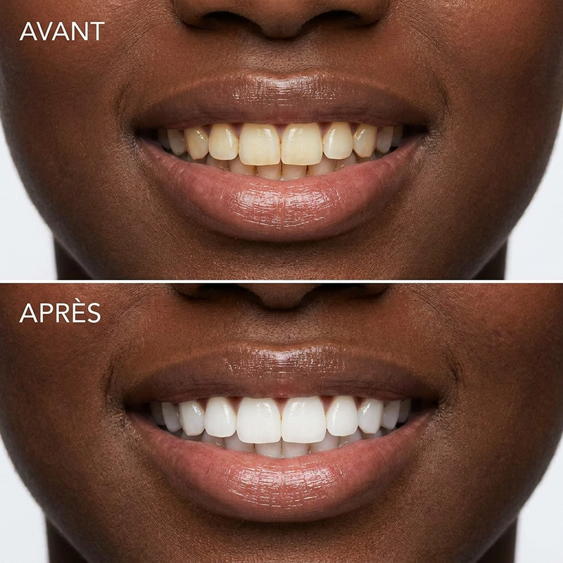 Parfait pour les dents sensibles !
