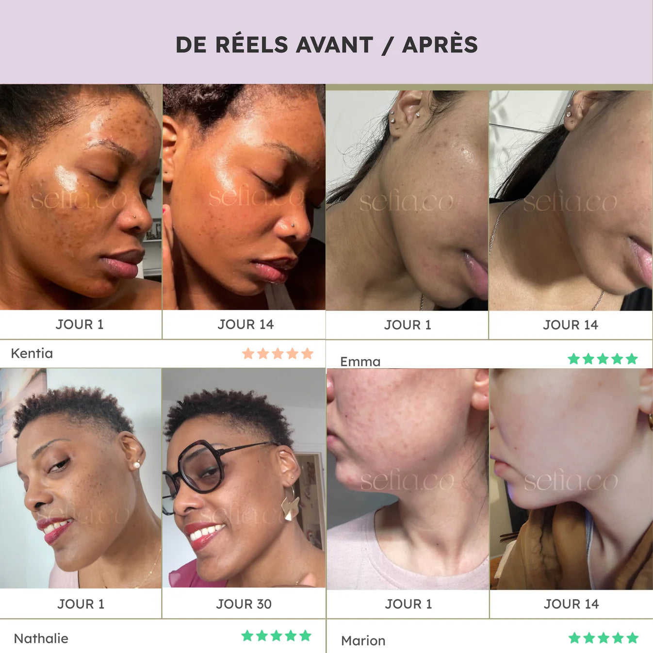 Cotons à l’acide kojique & curcuma – anti-imperfections