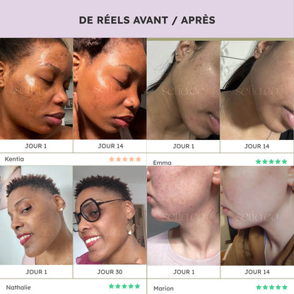 Cotons à l’acide kojique & curcuma – anti-imperfections